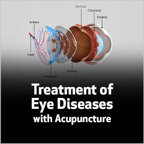 Treatment of Eye Diseases with Acupuncture